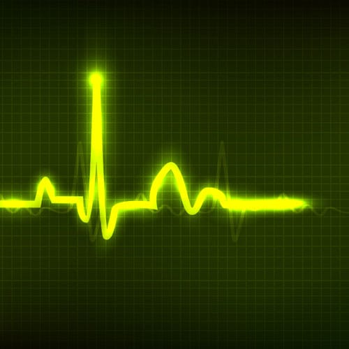 Dominant-signal-peak-over-random-noise
