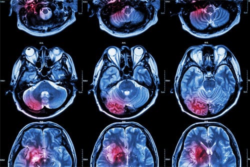 MRI-Image-sections-of-Human-Brain